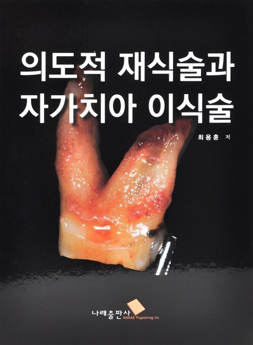 저서 「의도적 재식술과 자가치아 이식술」 표지