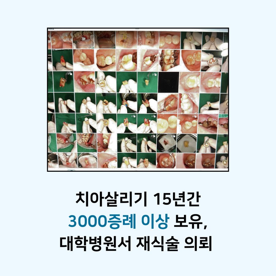 치아살리기 15년간 3000증례 이상 보유, 대학병원에서 재식술 의뢰