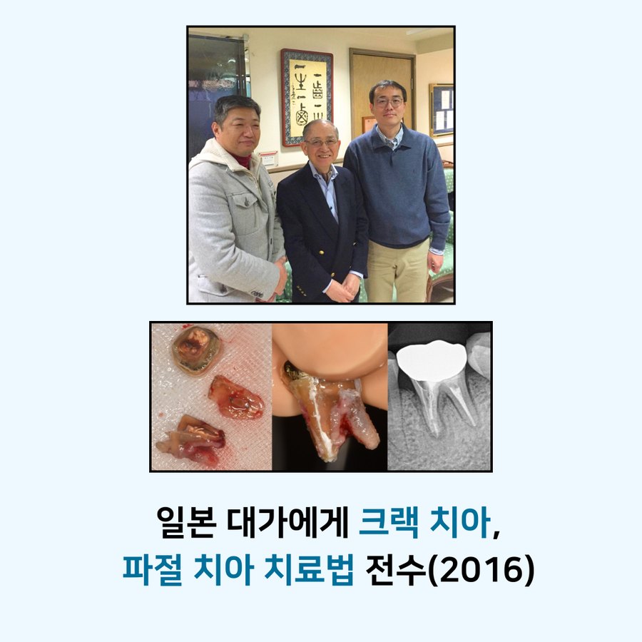 2016년 일본 대가에게 크랙 치아, 파절 치아 치료법 전수